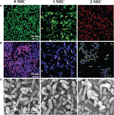 Isobavachalcone exhibits antifungal and antibiofilm effects against C. albicans by disrupting cell wall/membrane integrity and inducing apoptosis and autophagy